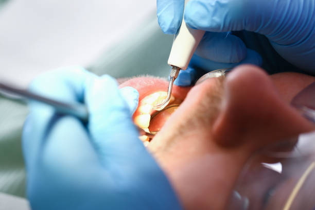 Best Urgent Dental Care for Toothache in Mount Pulaski, IL