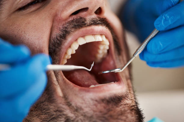 Best Weekend Emergency Dentist in Mount Pulaski, IL
