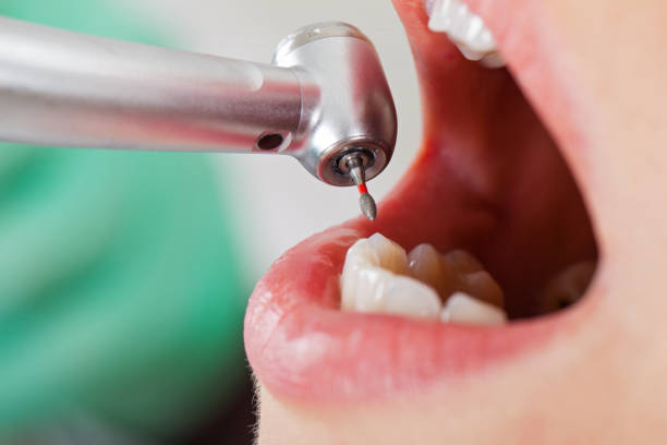 Best Weekend Emergency Dentist in Mount Pulaski, IL